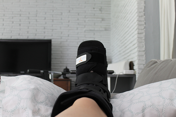 Bunion Surgery Recovery - Directions Not Included